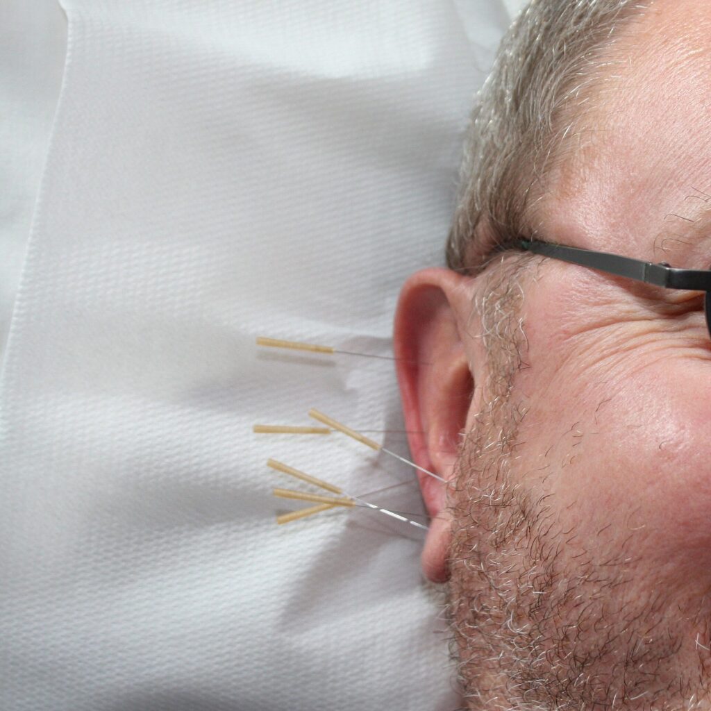 Auriculotherapy in in Ponce Medical Acupuncture and Intravenous Therapy with Dr Antonio Gonzalez Sotomayor with Dr Antonio Gonzalez Sotomayor